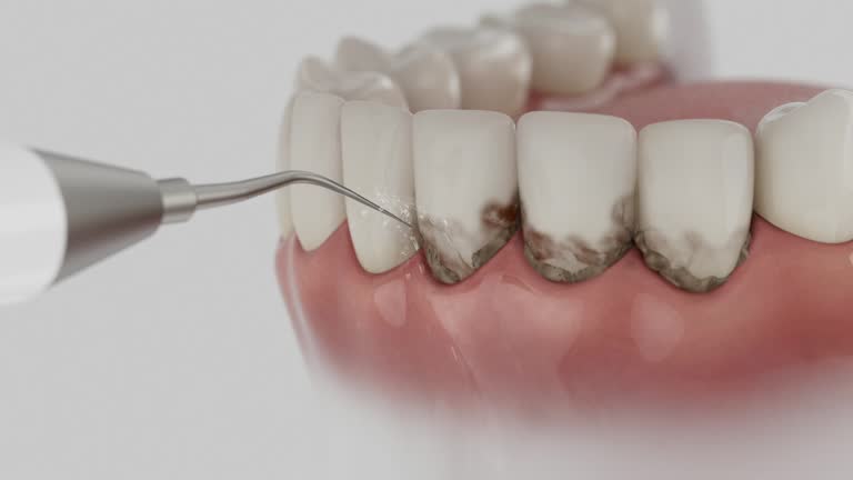 Trusted Teeth Cleaning And Checkup service in Georgetown, KY - Dentist Open Now